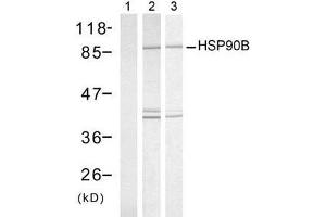 Western blot analysis of extract from HeLa cells, untreated or treated with UV or Heat shock, using HSP90B (Ab-254) antibody (E021290). (HSP90AB1 Antikörper)