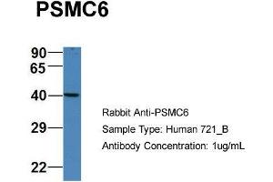 Host: Rabbit Target Name: PSMC6 Sample Type: Human 721_B Antibody Dilution: 1. (PSMC6 Antikörper  (C-Term))