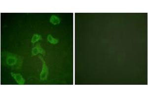 Immunofluorescence (IF) image for anti-Interleukin 2 Receptor, beta (IL2RB) (AA 331-380) antibody (ABIN2888883) (IL2 Receptor beta Antikörper  (AA 331-380))