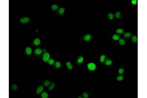 Immunofluorescence staining of Hela cells with ABIN7139605 at 1:7. (HIST1H4A Antikörper  (meLys59))