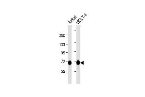 All lanes : Anti-Z Antibody  at 1:1000 dilution Lane 1: Jurkat whole cell lysate Lane 2: MOLT-4 whole cell lysate Lysates/proteins at 20 μg per lane. (ZAP70 Antikörper  (AA 252-282))