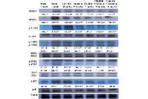 Western Blotting (WB) image for anti-Signal Transducer and Activator of Transcription 3 (Acute-Phase Response Factor) (STAT3) (C-Term) antibody (ABIN2855865)