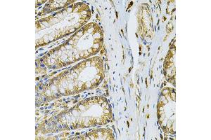 Immunohistochemistry of paraffin-embedded rat intestine using RRAGC Antibody (ABIN4905065) at dilution of 1:100 (40x lens). (GTR2 Antikörper)