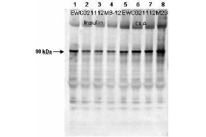 Affinity Purified Phospho-specific antibody to human muscle Glycogen Synthase (GS) at pS640 was used at a 1:1000 dilution to detect human muscle GS by Western blot. (Glycogen Synthase 1 Antikörper  (pSer640))