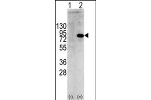 Western blot analysis of PIK3R1 (arrow) using rabbit polyclonal PIK3R1 Antibody  f. (PIK3R1 Antikörper  (AA 558-587))