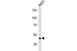 Western Blotting (WB) image for anti-Fibrinogen gamma Chain (FGG) antibody (ABIN3003142) (FGG Antikörper)