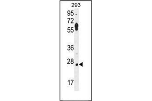 LRRC57 Antikörper  (C-Term)