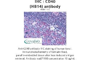 Image no. 1 for anti-CD40 (CD40) antibody (ABIN1724028) (CD40 Antikörper)