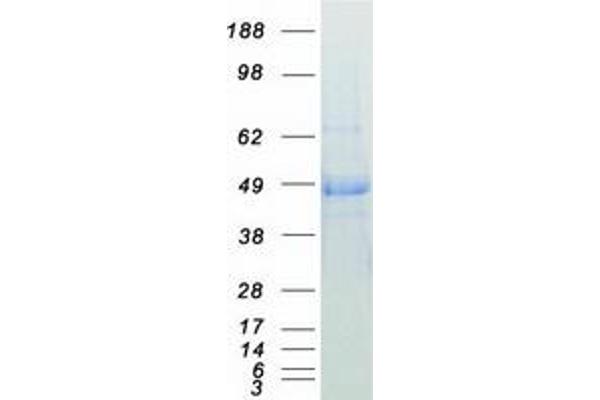 DNAJA1 Protein (Myc-DYKDDDDK Tag)