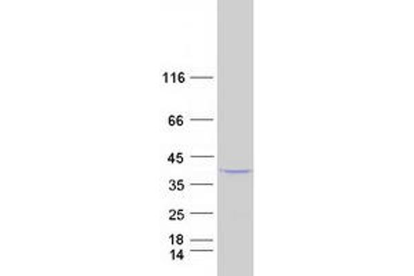 PLCXD1 Protein (Myc-DYKDDDDK Tag)