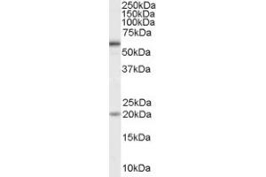 Image no. 1 for anti-Bone Morphogenetic Protein Receptor 1A (BMPR1A) (Internal Region) antibody (ABIN374667) (BMPR1A Antikörper  (Internal Region))