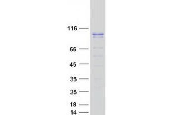 GMEB1 Protein (Transcript Variant 2) (Myc-DYKDDDDK Tag)