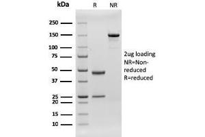 SDS-PAGE Analysis Purified CD79b Recombinant Mouse Monoclonal Antibody (rIGB/1842). (Rekombinanter CD79b Antikörper  (AA 29-159))