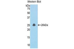 Western Blotting (WB) image for anti-Coiled-Coil Domain Containing 80 (CCD80) (AA 82-288) antibody (ABIN1176793) (CCDC80 Antikörper  (AA 82-288))