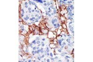 Image no. 2 for anti-Phosphatidylinositol-5-Phosphate 4-Kinase, Type II, beta (PIP4K2B) (C-Term) antibody (ABIN360485) (PIP4K2B Antikörper  (C-Term))