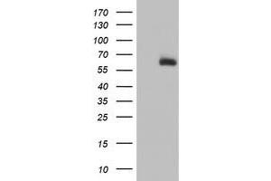 Western Blotting (WB) image for anti-ACSM5 / MACS3 antibody (ABIN1496425) (ACSM5 / MACS3 Antikörper)