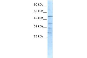 WB Suggested Anti-CHRNA1 Antibody Titration:  0. (CHRNA1 Antikörper  (N-Term))