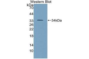 Western Blotting (WB) image for anti-Tumor Protein P53 (TP53) (AA 134-387) antibody (ABIN1078634) (p53 Antikörper  (AA 134-387))