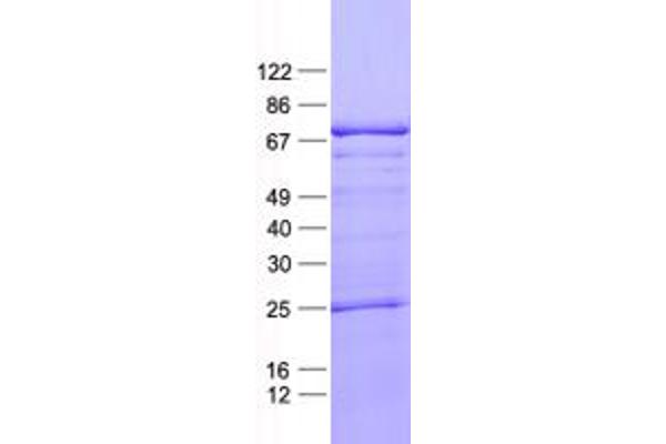 LZTS1 Protein (His tag)