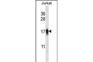 Western blot analysis in Jurkat cell line lysates (35ug/lane). (CENPA Antikörper  (AA 82-110))