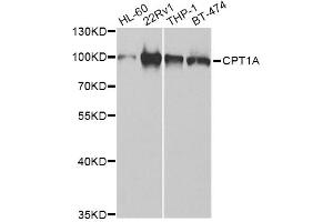 Western blot analysis of extracts of various cell lines, using CPT1A Antibody. (CPT1A Antikörper)