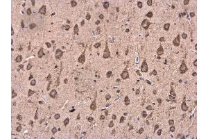 IHC-P Image BACE1 antibody [N1C2] detects BACE1 protein at cytoplasm in Rat brain by immunohistochemical analysis. (BACE1 Antikörper)