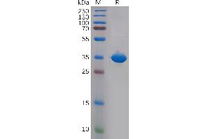 CD81 Protein (CD81) (AA 113-201) (Fc Tag)