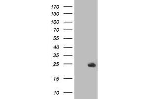 HEK293T cells were transfected with the pCMV6-ENTRY control (Left lane) or pCMV6-ENTRY DTYMK (Right lane) cDNA for 48 hrs and lysed. (DTYMK Antikörper)