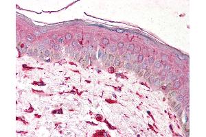 Anti-Vimentin antibody IHC of human skin. (Vimentin Antikörper)