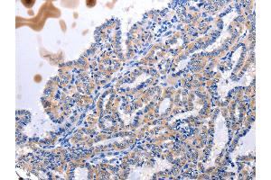 Immunohistochemistry (IHC) image for anti-Urotensin 2 (UTS2) antibody (ABIN2427518) (Urotensin 2 Antikörper)