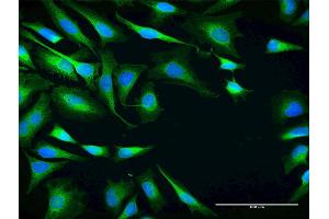 Immunofluorescence of purified MaxPab antibody to SRPR on HeLa cell. (SRPR Antikörper  (AA 1-638))