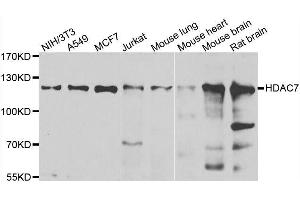 HDAC7 Antikörper  (AA 400-500)