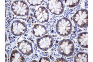 Image no. 2 for anti-Mast/stem Cell Growth Factor Receptor (KIT) (AA 546-976) antibody (ABIN1491586) (KIT Antikörper  (AA 546-976))