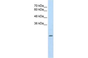 Western Blotting (WB) image for anti-Aldehyde Dehydrogenase 4 Family, Member A1 (ALDH4A1) antibody (ABIN2462883) (ALDH4A1 Antikörper)