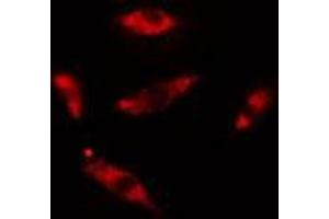 ABIN6275437 staining HuvEc cells by IF/ICC. (Rabenosyn 5 Antikörper  (Internal Region))