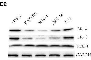 PELP1 expression was elevated in gastric cancer tissues and cells comparing with corresponding counterparts. (PELP1 Antikörper)