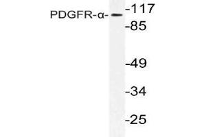 Western blot (WB) analysis of PDGFR-alpha antibody in extracts from Jurkat cells. (PDGFRA Antikörper)