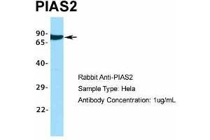 Host:  Rabbit  Target Name:  PIAS2  Sample Type:  Hela  Antibody Dilution:  1. (PIAS2 Antikörper  (C-Term))