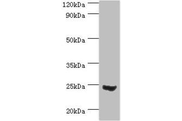 MAD2L1 Antikörper（AA 1-205）