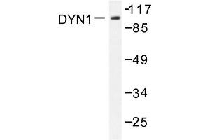 Image no. 1 for anti-Dynamin 1 (DNM1) antibody (ABIN271884) (Dynamin 1 Antikörper)