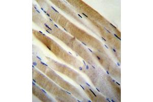 Immunohistochemistry (IHC) image for anti-Protein Kinase, AMP-Activated, alpha 2 Catalytic Subunit (PRKAA2) antibody (ABIN2995875) (PRKAA2 Antikörper)