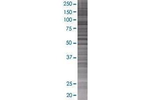 KLHL22 transfected lysate. (KLHL22 293T Cell Transient Overexpression Lysate(Denatured))