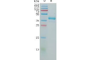 Human GNRHR Protein, hFc Tag on SDS-PAGE under reducing condition. (GNRHR Protein (AA 1-38) (Fc Tag))