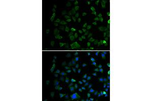 Immunofluorescence analysis of U2OS cell using MAP2K1 antibody. (MEK1 Antikörper)