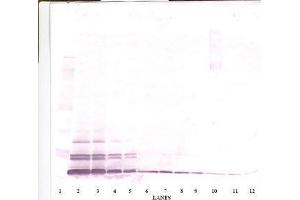 Image no. 1 for anti-Chemokine (C-C Motif) Ligand 26 (CCL26) antibody (ABIN465091) (CCL26 Antikörper)