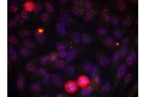 Immunofluorescence staining of methanol-fixed HeLa cells using Elk-1 (phospho-Thr417) antibody (E011038, Red) (ELK1 Antikörper  (pThr417))