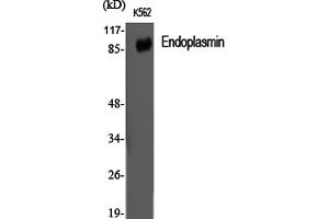 Western Blotting (WB) image for anti-Heat Shock Protein 90kDa beta (Grp94), Member 1 (HSP90B1) antibody (ABIN5959523) (GRP94 Antikörper)