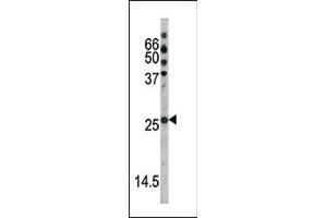 The anti-Phospho-p27Kip1- Pab (ABIN389615 and ABIN2839619) is used in Western blot to detect Phospho-p27Kip1- in HL60 tissue lysate (CDKN1B Antikörper  (pSer178))