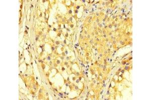 Immunohistochemistry of paraffin-embedded human testis tissue using ABIN7150987 at dilution of 1:100 (RNF2 Antikörper  (AA 1-100))