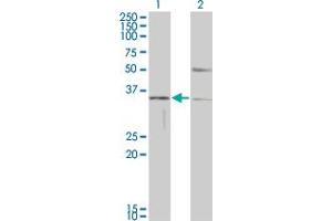 Western Blot analysis of HAVCR1 expression in transfected 293T cell line by HAVCR1 monoclonal antibody (M01), clone 1E5. (HAVCR1 Antikörper  (AA 23-122))